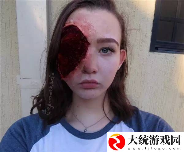 经历丰富的13一14处出血全过程